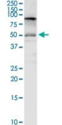 Western Blot: CD98 Antibody [H00006520-D01P]