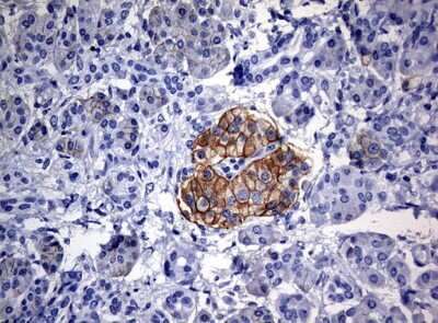 Immunohistochemistry-Paraffin: CD99 Antibody (OTI1D5) [NBP2-46181]