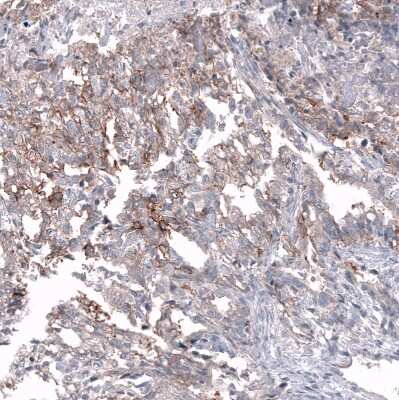 Immunohistochemistry-Paraffin: CD99 Antibody (CL12929) [NBP3-18550]