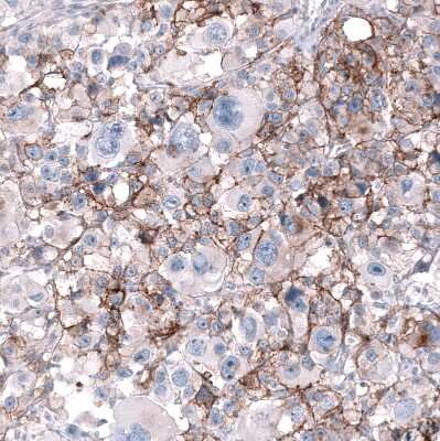 Immunohistochemistry-Paraffin: CD99 Antibody (CL12929) [NBP3-18550]