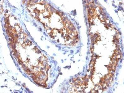 Immunohistochemistry-Paraffin: CD99 Antibody (HO36-1.1) - Azide and BSA Free [NBP2-47894]