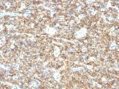 Immunohistochemistry-Paraffin: CD99 Antibody (HO36-1.1) [NBP2-44692]