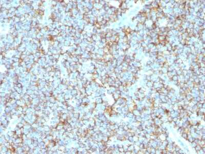 Immunohistochemistry-Paraffin: CD99 Antibody (MIC2/1495R) - Azide and BSA Free [NBP2-54373]