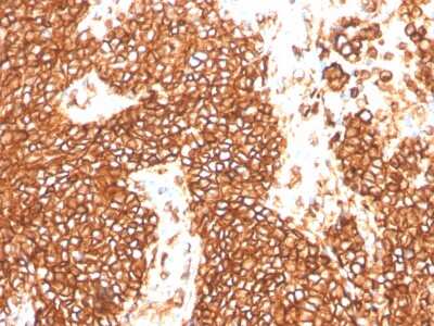 Immunohistochemistry-Paraffin: CD99 Antibody (MIC2/3478R) - Azide and BSA Free [NBP3-08589]