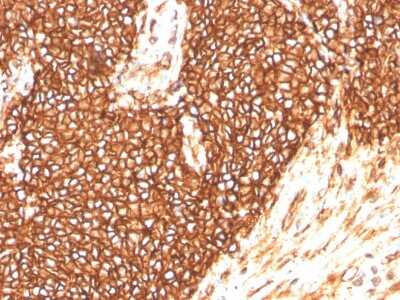 Immunohistochemistry-Paraffin: CD99 Antibody (MIC2/3478R) [NBP3-07315]
