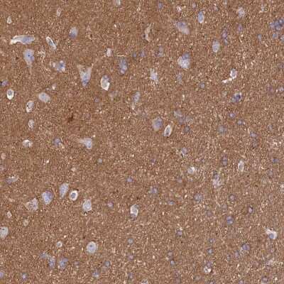 Immunohistochemistry-Paraffin: CD99-L2 Antibody [NBP1-85738]