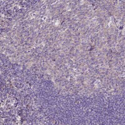 Immunohistochemistry-Paraffin: CD99-L2 Antibody [NBP1-85738]
