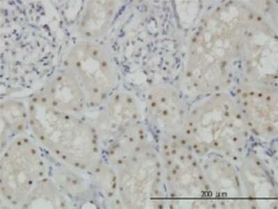 Immunohistochemistry-Paraffin: CDADC1 Antibody (1A2) [H00081602-M01]