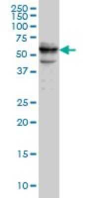 Western Blot: CDADC1 Antibody (1A2) [H00081602-M01]