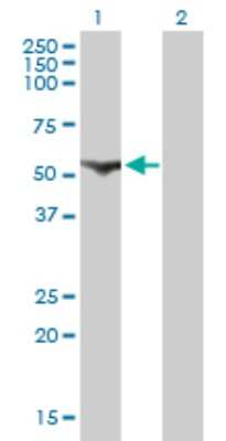 Western Blot: CDADC1 Antibody (1A2) [H00081602-M01]