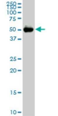 Western Blot: CDADC1 Antibody (2E8) [H00081602-M02]