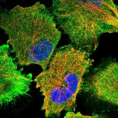 Immunocytochemistry/ Immunofluorescence: CDAN1 Antibody [NBP1-84574]