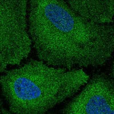 Immunocytochemistry/ Immunofluorescence: CDAN1 Antibody [NBP2-38473]