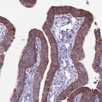 Immunohistochemistry-Paraffin: CDAN1 Antibody [NBP2-38473]