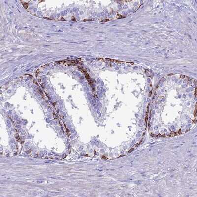 Immunohistochemistry-Paraffin: CDAN1 Antibody [NBP2-38473]