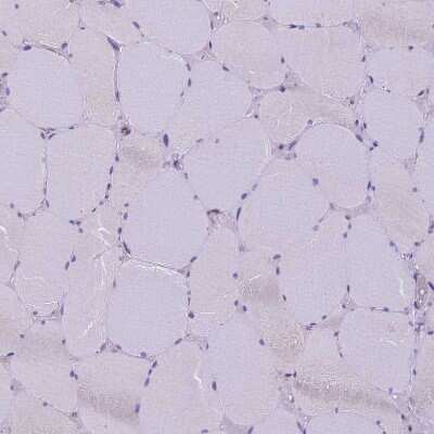 Immunohistochemistry-Paraffin: CDAN1 Antibody [NBP2-38473]