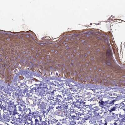 Immunohistochemistry-Paraffin: CDAN1 Antibody [NBP2-38473]