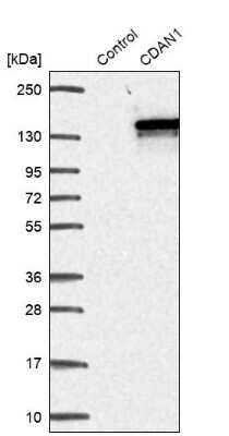 Western Blot: CDAN1 Antibody [NBP2-38473]