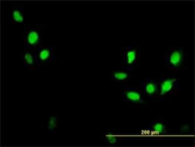 Immunocytochemistry/ Immunofluorescence: CDC2/CDK1 Antibody (1A4-1A9) [H00000983-M01]