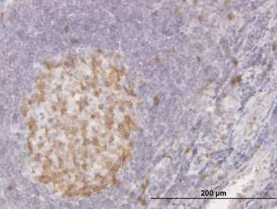 Immunohistochemistry-Paraffin: CDC2/CDK1 Antibody (8F1) [H00000983-M04]