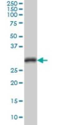 Western Blot: CDC2/CDK1 Antibody (8F1) [H00000983-M04]