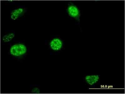 Immunocytochemistry/ Immunofluorescence: CDC20B Antibody (2F2) [H00166979-M11]