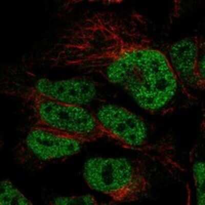 Immunocytochemistry/ Immunofluorescence: CDC25A Antibody [NBP3-17816]