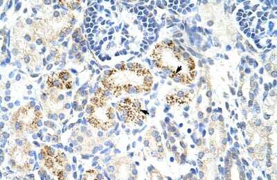 Immunohistochemistry-Paraffin: CDC25B Antibody [NBP1-58076]