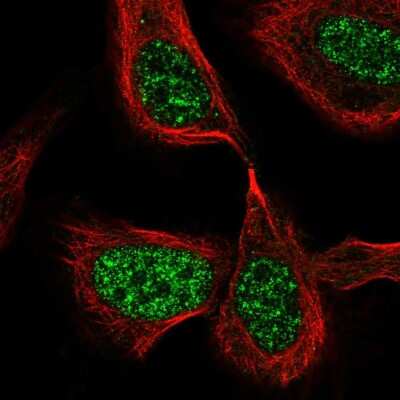 Immunocytochemistry/ Immunofluorescence: CDC25C Antibody [NBP2-57705]