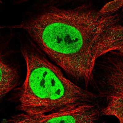 Immunocytochemistry/ Immunofluorescence: CDC26 Antibody [NBP1-91771]