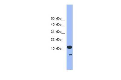 Western Blot: CDC26 Antibody [NBP2-84638]