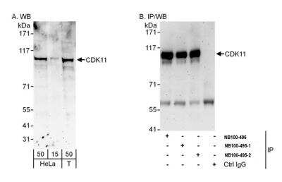 Immunoprecipitation: CDC2L2 Antibody [NB100-495]