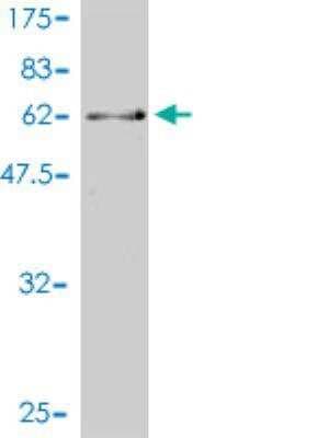 Western Blot: CDC2L5 Antibody (1B3-1B11) [H00008621-M01]