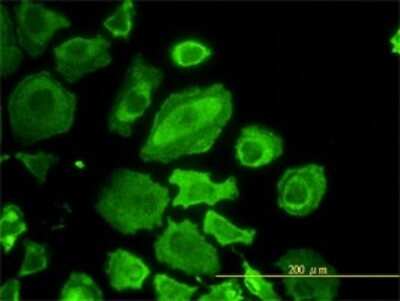 Immunocytochemistry/ Immunofluorescence: CDC37 Antibody (3C7) [H00011140-M01]