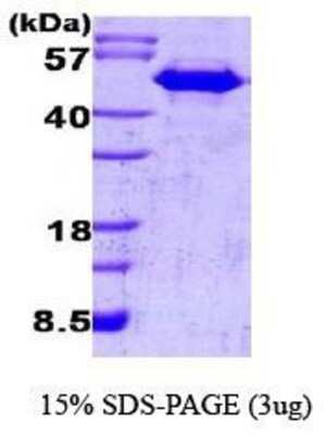 SDS-PAGE: Recombinant Human CDC37 Protein [NBC1-18377]
