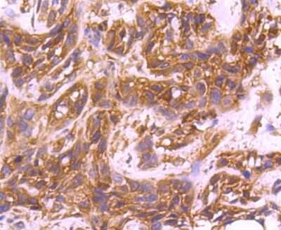 Immunohistochemistry-Paraffin: CDC42 Antibody (JJ086-04) [NBP2-67895]
