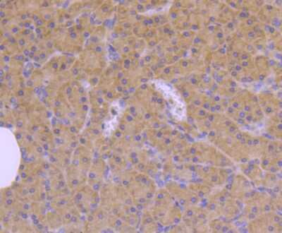 Immunohistochemistry-Paraffin: CDC42 Antibody (JJ086-04) [NBP2-67895]