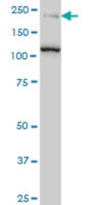 Western Blot: CDC42BPB Antibody (2D8) [H00009578-M04]