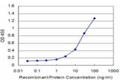 ELISA: CDC42BPB Antibody (2F4) [H00009578-M03]