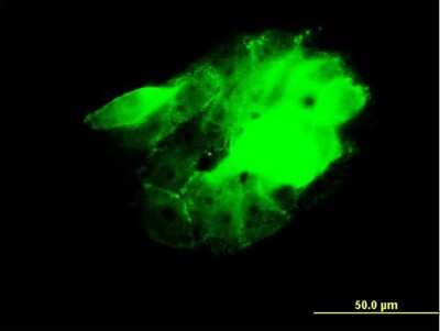 Immunocytochemistry/ Immunofluorescence: CDC42BPB Antibody (2F4) [H00009578-M03]