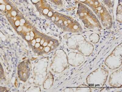 Immunohistochemistry-Paraffin: CDC42BPB Antibody (2F4) [H00009578-M03]