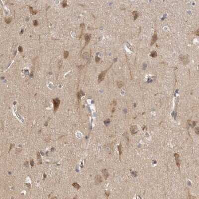 Immunohistochemistry-Paraffin: CDC42BPB Antibody [NBP1-81440]
