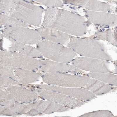 Immunohistochemistry-Paraffin: CDC42BPB Antibody [NBP1-81440]