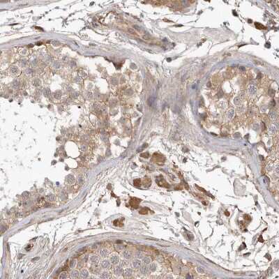 Immunohistochemistry-Paraffin: CDC42BPB Antibody [NBP1-81440]