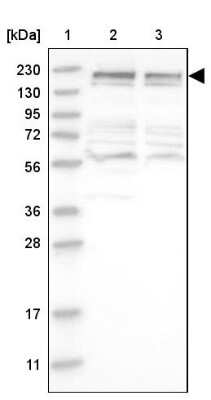 Western Blot: CDC42BPB Antibody [NBP1-81440]