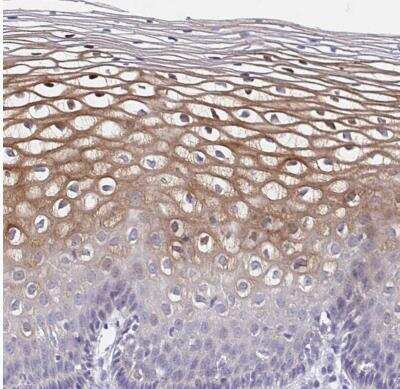 Immunohistochemistry-Paraffin: CDC42BPG Antibody [NBP2-38938]