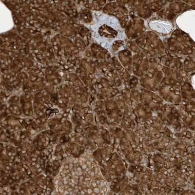 Immunohistochemistry-Paraffin: CDC42EP3 Antibody [NBP1-88382]