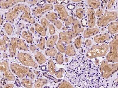 Immunohistochemistry-Paraffin: CDC42EP4 Antibody [NBP2-97311]