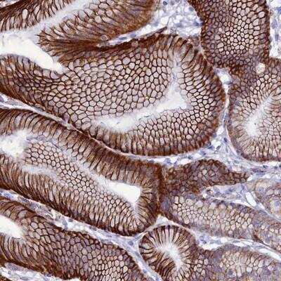 Immunohistochemistry-Paraffin: CDC42EP5 Antibody [NBP1-91773]