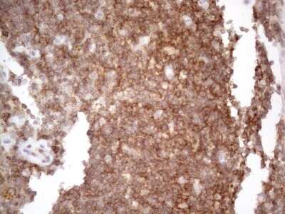 Immunohistochemistry: CDC42SE2 Antibody (OTI1B12) [NBP2-46191]